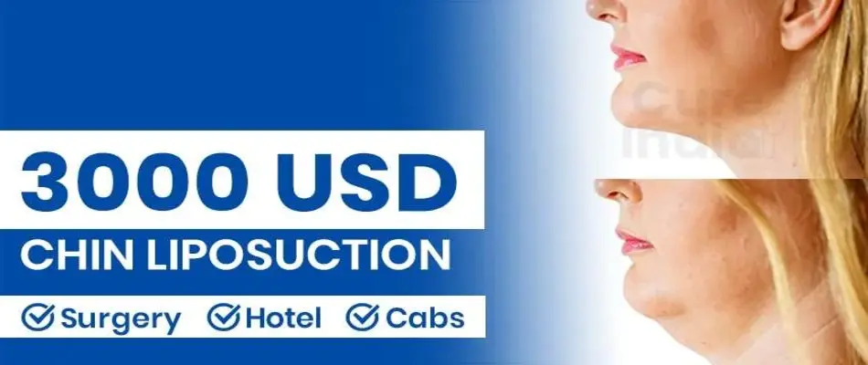 Chin Liposuction Cost